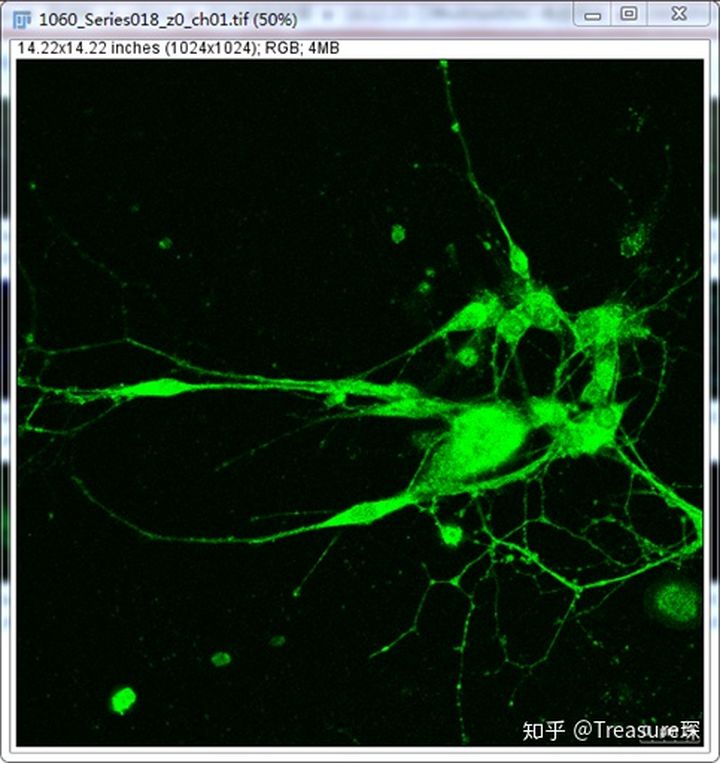 ImageJ实用技巧——平均荧光强度检测(定量分析篇)