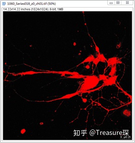 ImageJ实用技巧——平均荧光强度检测(定量分析篇)