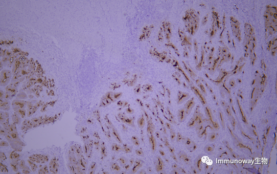 免疫组化（IHC）│常见问题及解析集锦