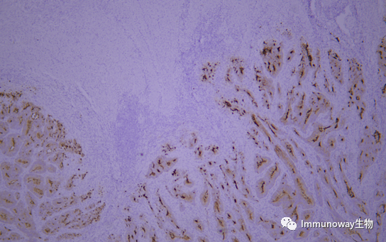 免疫组化（IHC）│常见问题及解析集锦