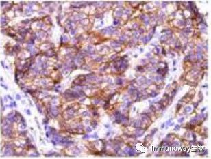 免疫组化（IHC）│常见问题及解析集锦