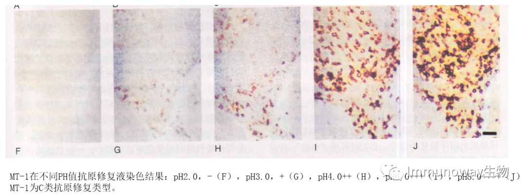 免疫组化（IHC）│常见问题及解析集锦