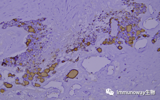 免疫组化（IHC）│常见问题及解析集锦