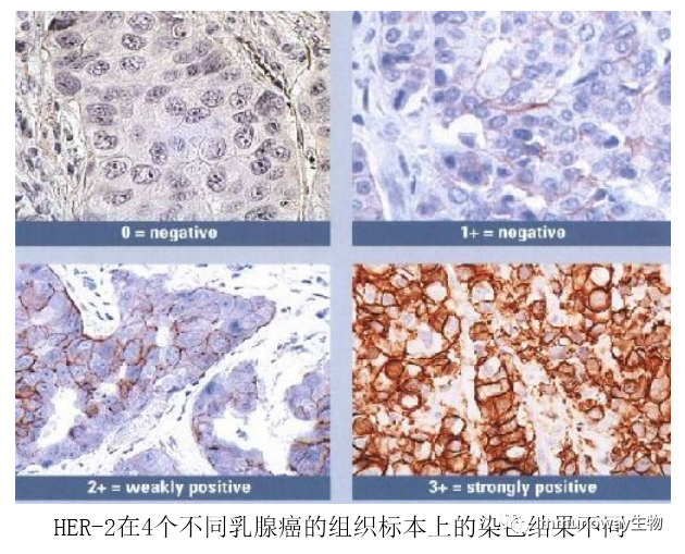 免疫组化（IHC）│常见问题及解析集锦