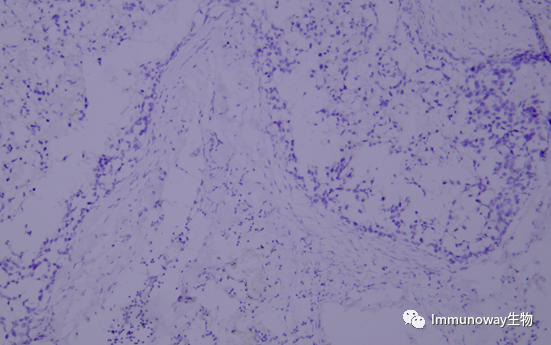 免疫组化（IHC）│常见问题及解析集锦