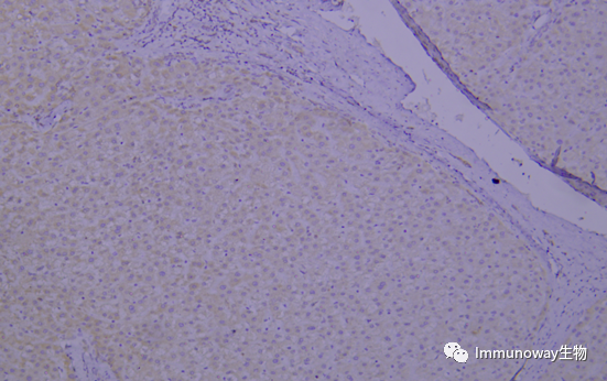 免疫组化（IHC）│常见问题及解析集锦