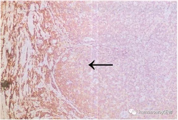 免疫组化（IHC）│常见问题及解析集锦