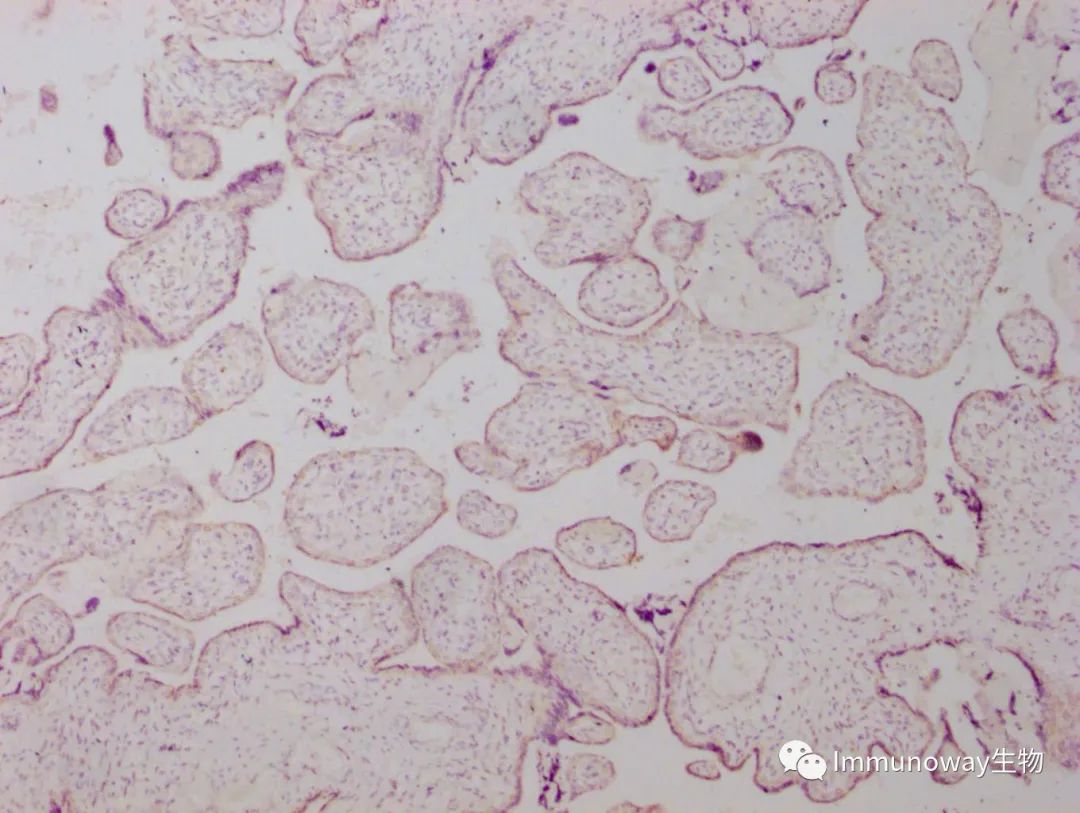 免疫组化（IHC）│常见问题及解析集锦