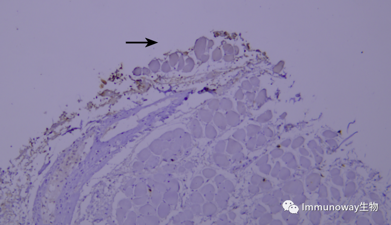 免疫组化（IHC）│常见问题及解析集锦