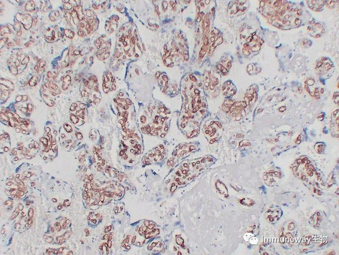 免疫组化（IHC）│常见问题及解析集锦