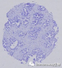 免疫组化（IHC）│常见问题及解析集锦