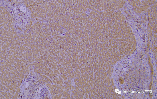 免疫组化（IHC）│常见问题及解析集锦