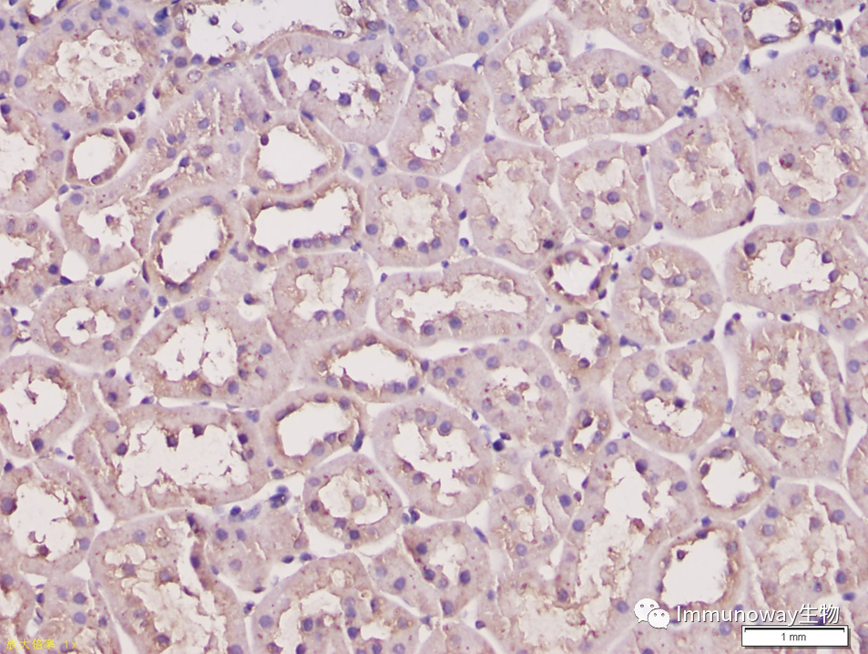 免疫组化（IHC）│常见问题及解析集锦