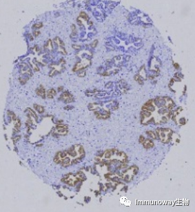 免疫组化（IHC）│常见问题及解析集锦