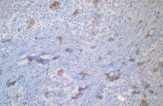 免疫组化（IHC）│常见问题及解析集锦