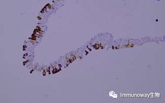 免疫组化（IHC）│常见问题及解析集锦