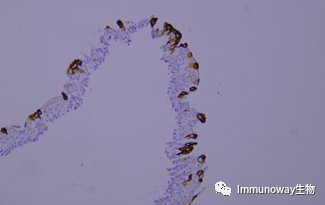 免疫组化（IHC）│常见问题及解析集锦