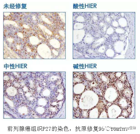 免疫组化（IHC）│常见问题及解析集锦