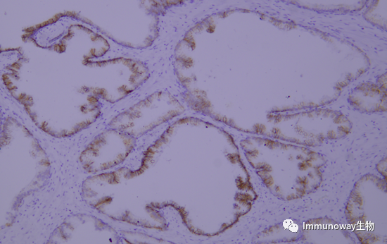 免疫组化（IHC）│常见问题及解析集锦