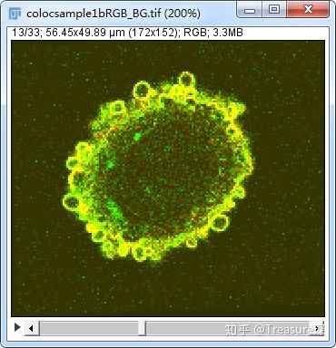 ImageJ实用技巧——荧光共定位分析(定量分析篇)