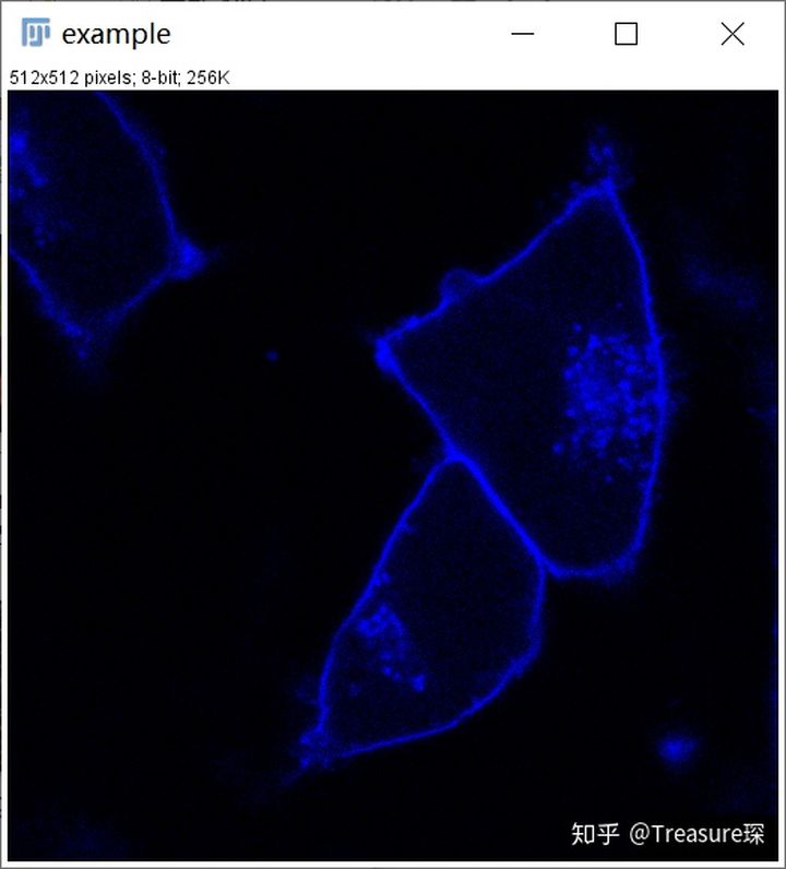 ImageJ实用教程——细胞膜荧光强度检测(定量分析篇)