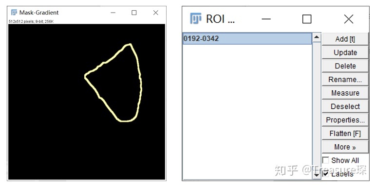 ImageJ实用教程——细胞膜荧光强度检测(定量分析篇)